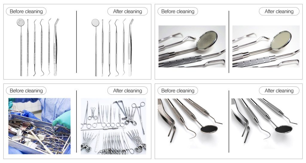 Ultrasonic Cleaner For Dental Instruments - Granbo Sonic